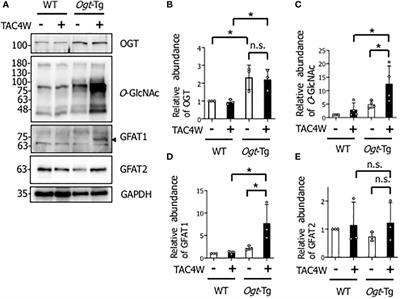 O-GlcNAcylation-induced GSK-3β activation deteriorates pressure overload-induced heart failure via lack of compensatory cardiac hypertrophy in mice